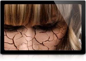 Cracked-Skin-Made-Easy