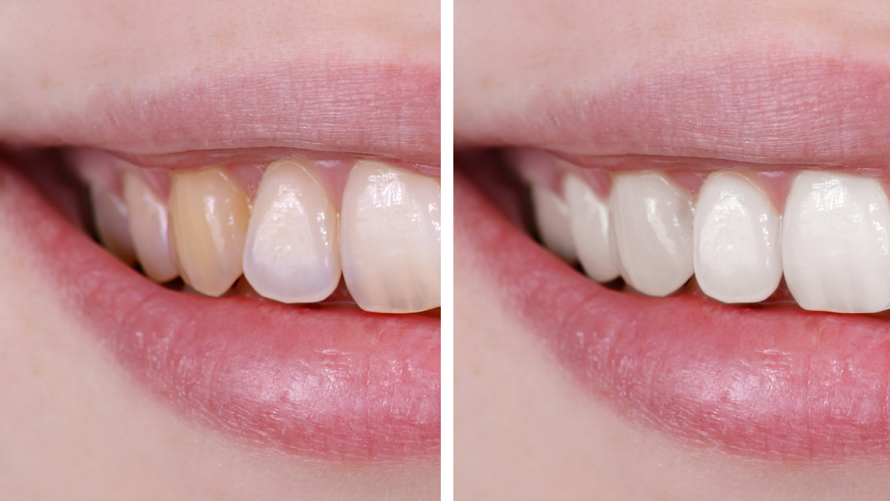 how to whiten your teeth using photoshop