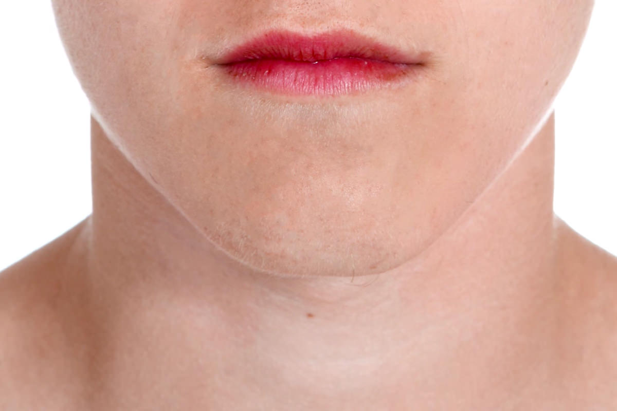 how to remove acne in photoshop phlearn