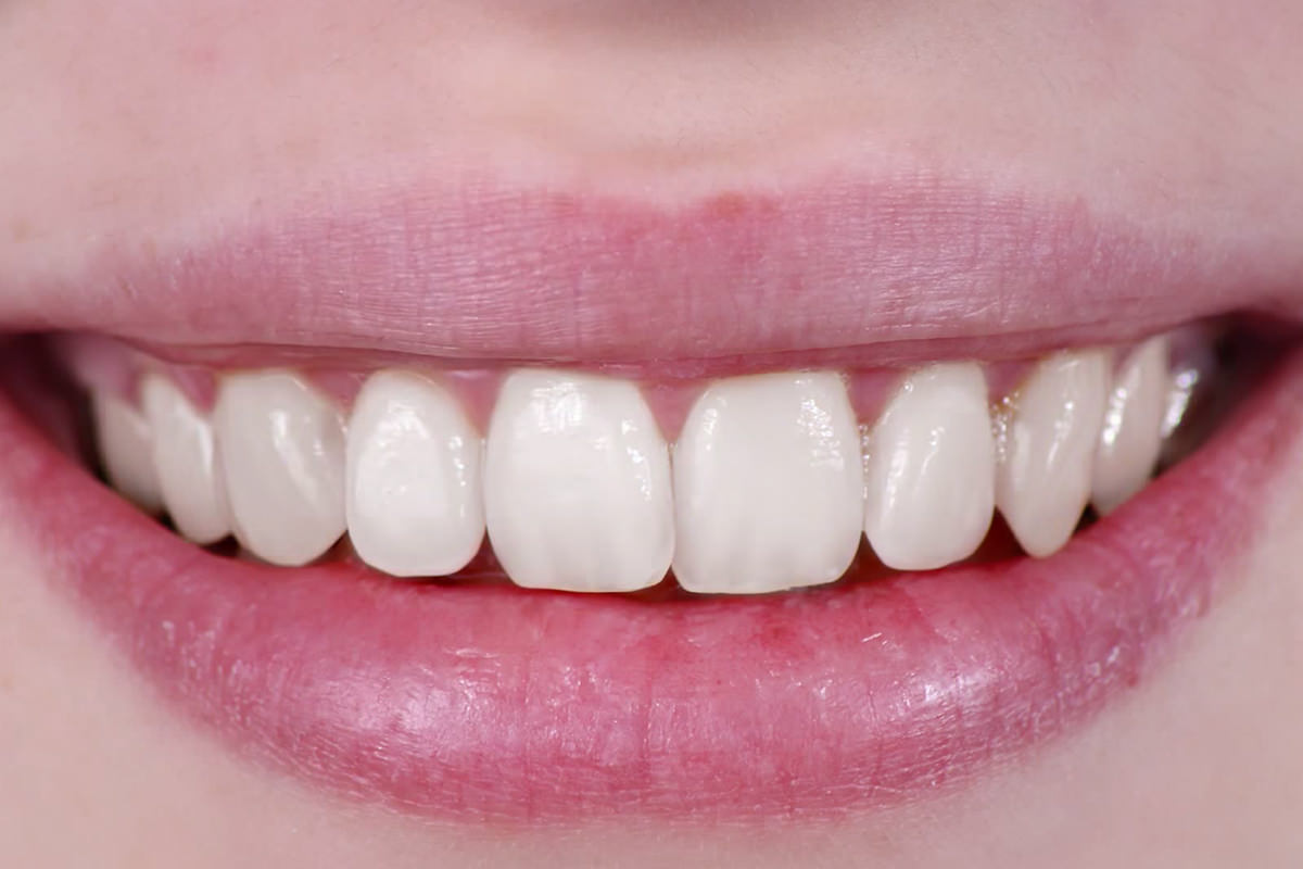 How To Whiten Teeth In Photoshop Phlearn