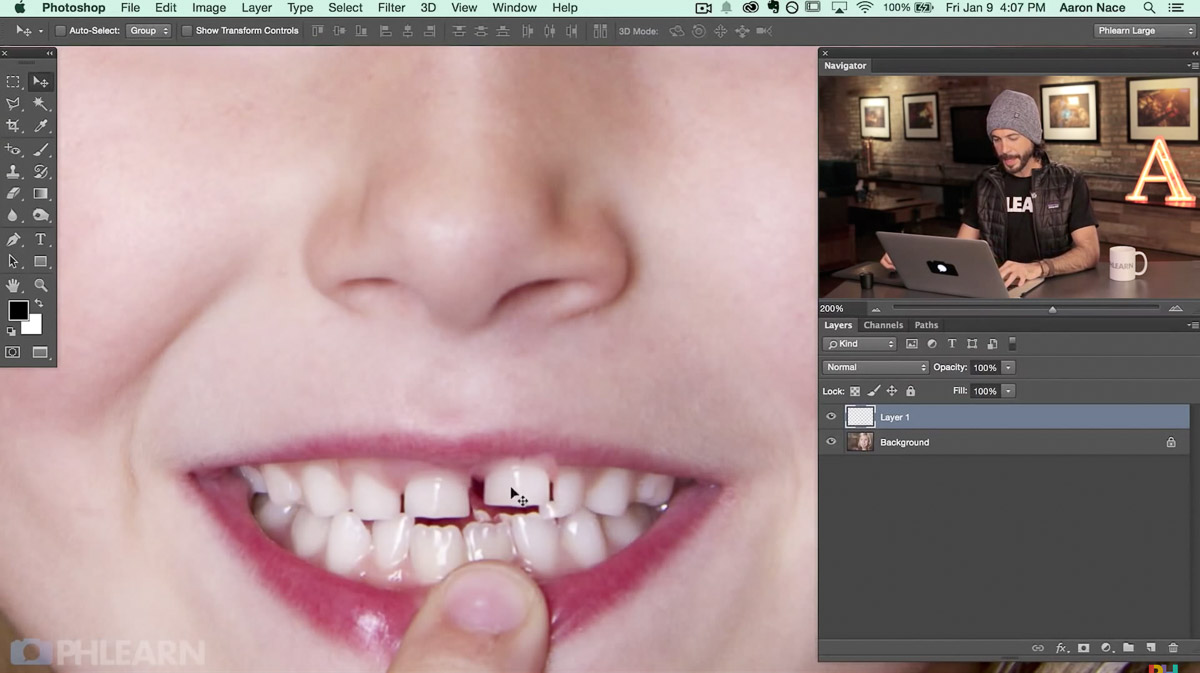 replace missing tooth in photoshop