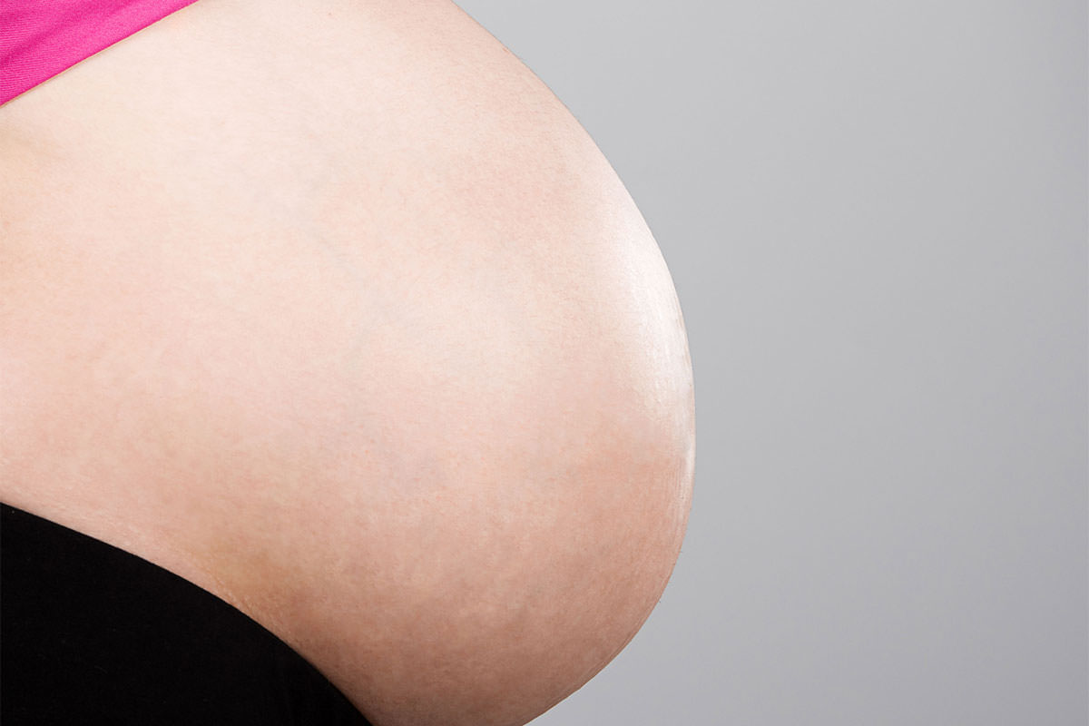 remove stretch marks in photoshop phlearn