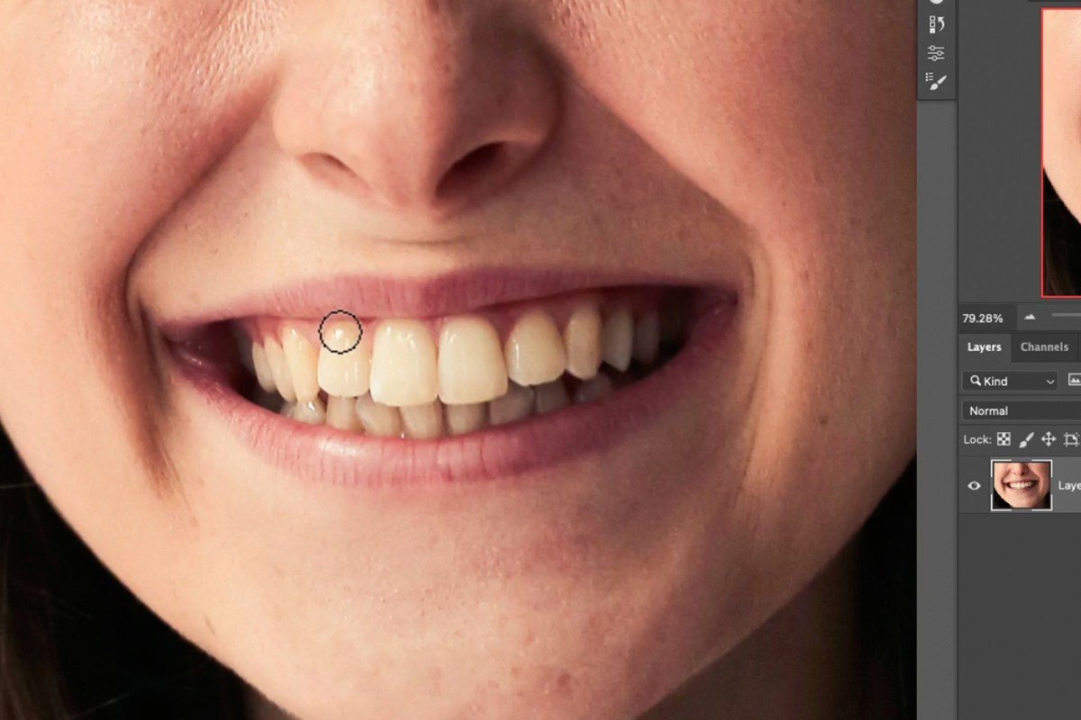the original portrait before whitening, with the eyedropper over the teeth