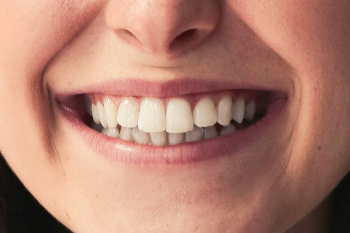 whiten teeth photoshop