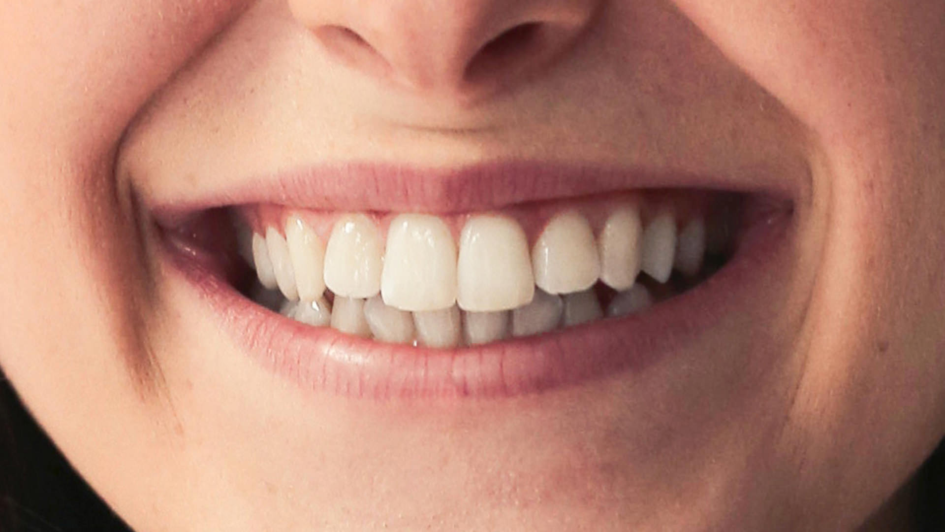 How to Whiten Teeth in Photoshop - PHLEARN