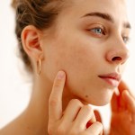 A woman touching her cheek
